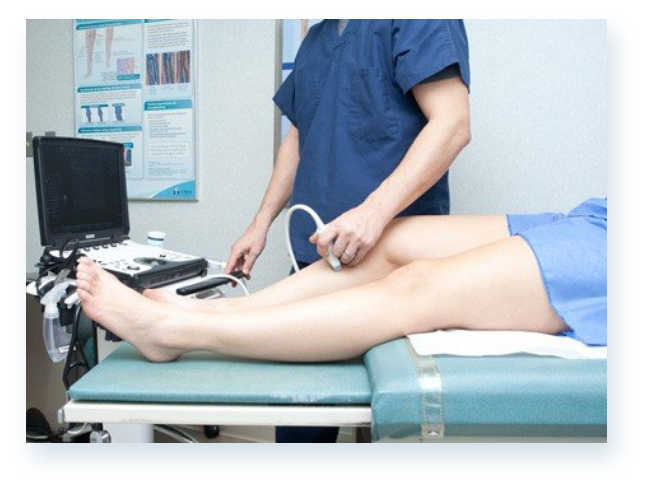 Vein symptoms visualization